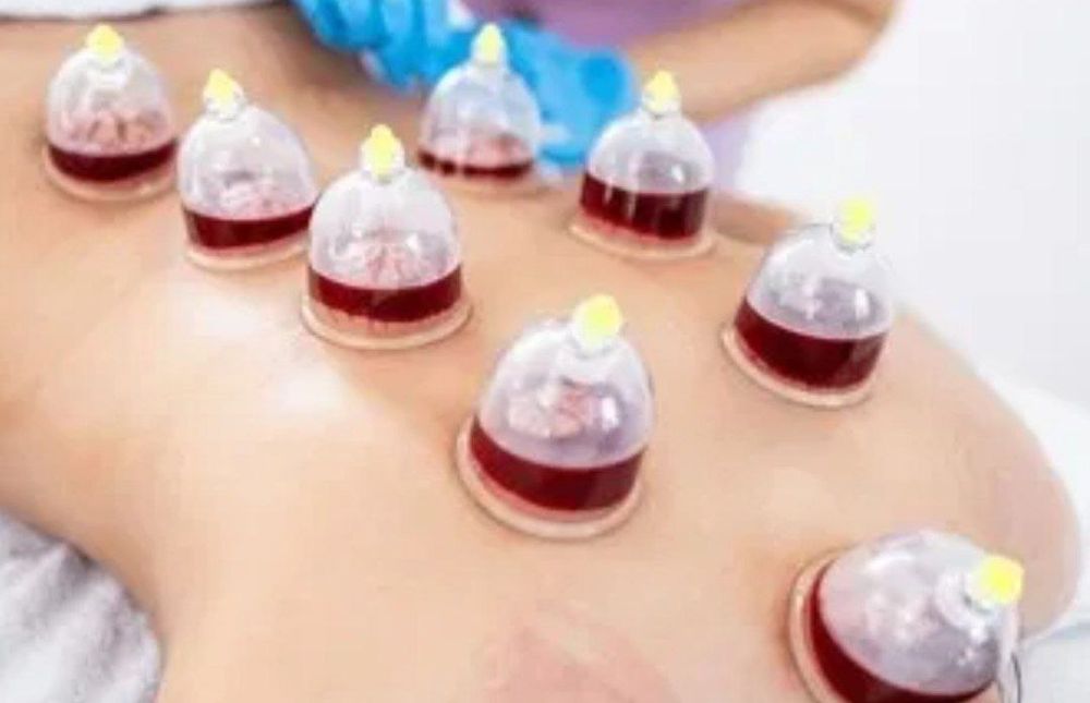 Хижама ва зулук куйиш даволаш