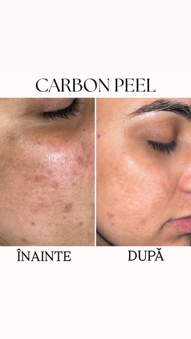 Manichiură gel - Pensat - Epilare definitivă cu laser IPL -
