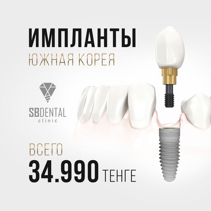 Имплантация зубов