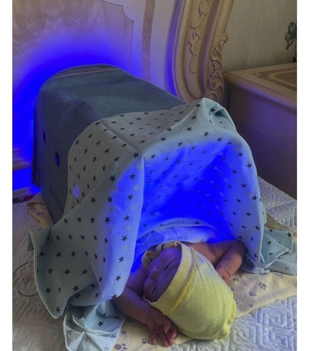 Фотолампа от желтухи