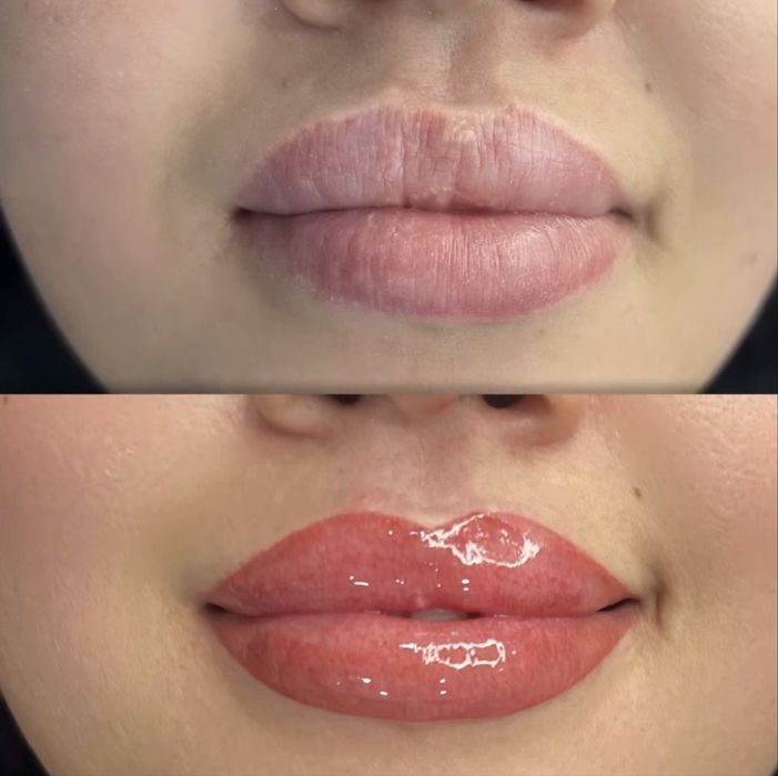 Kosmetologik muolajalar va qosh rastishovkasi