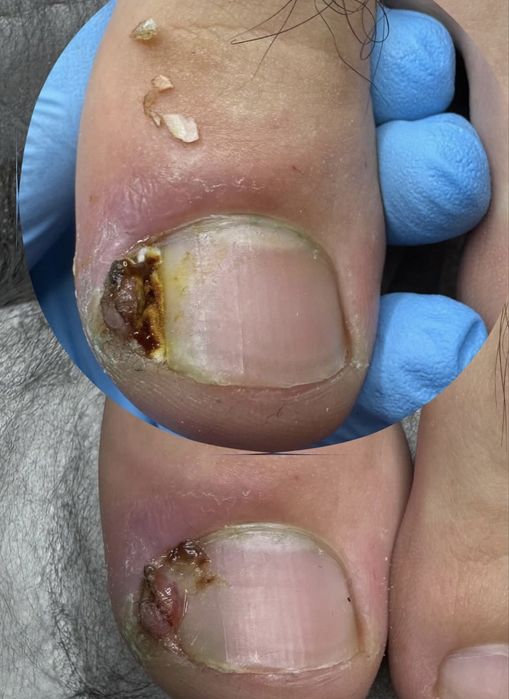 Мужской педикюр от А до Я