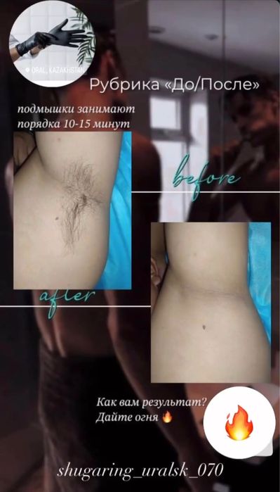 Депиляция - Уральск