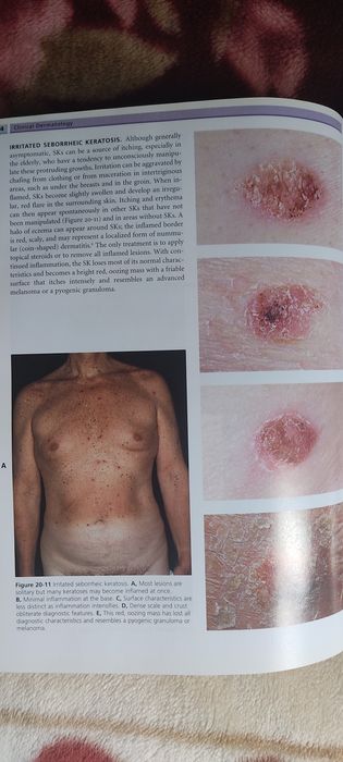 Carte Clinical Dermatology