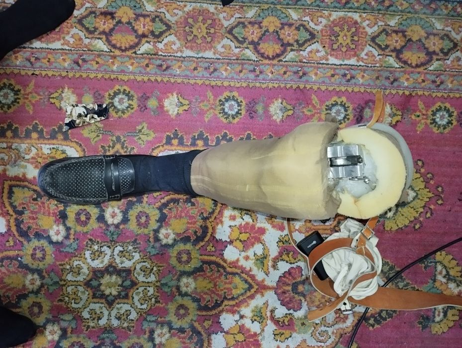 Протез левой ноги выше колени