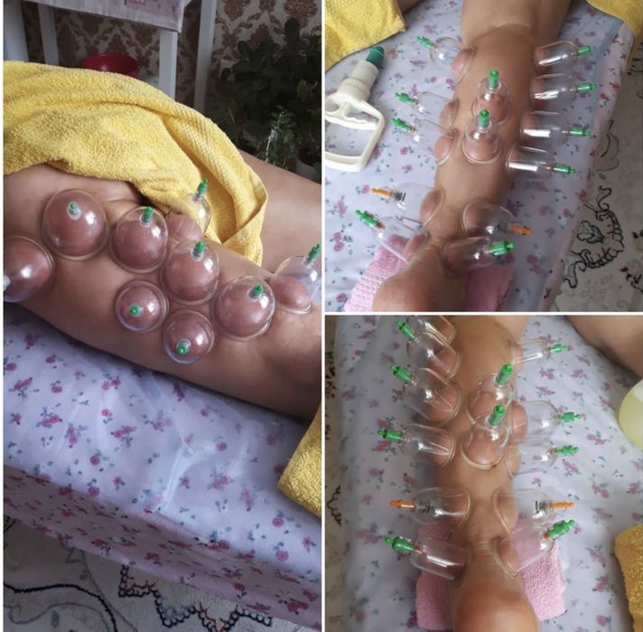 Все вида массажа
