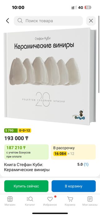 Керамические Виниры