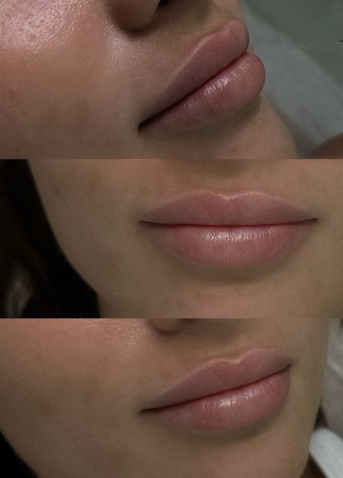 Услуги косметолога