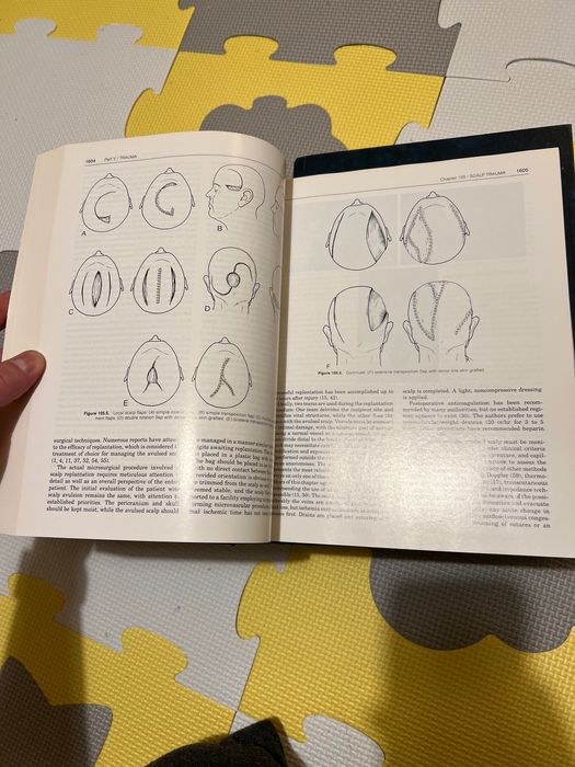 Неврохирургия на Тиндал 3 тома. Practice of Neurosurgery Tindall