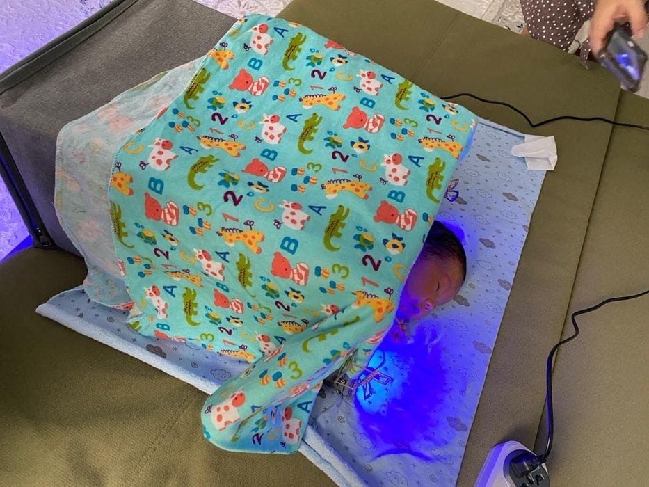 Лампа от желтушки