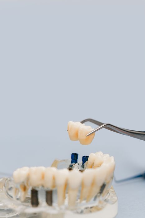 Хирург имплантолог