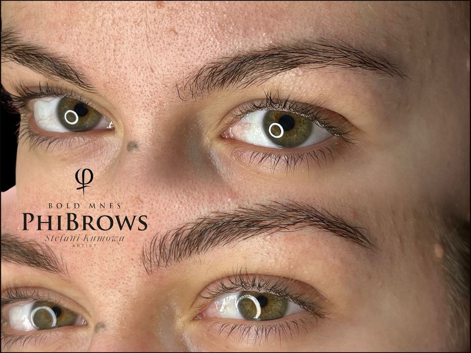 Процедура Микроблейдинг