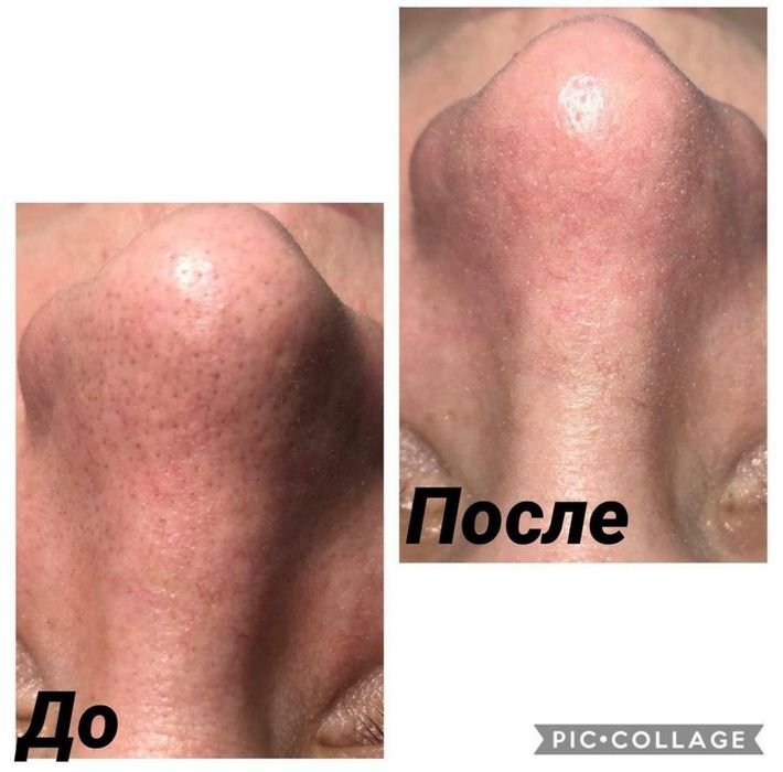 Услуги косметолога