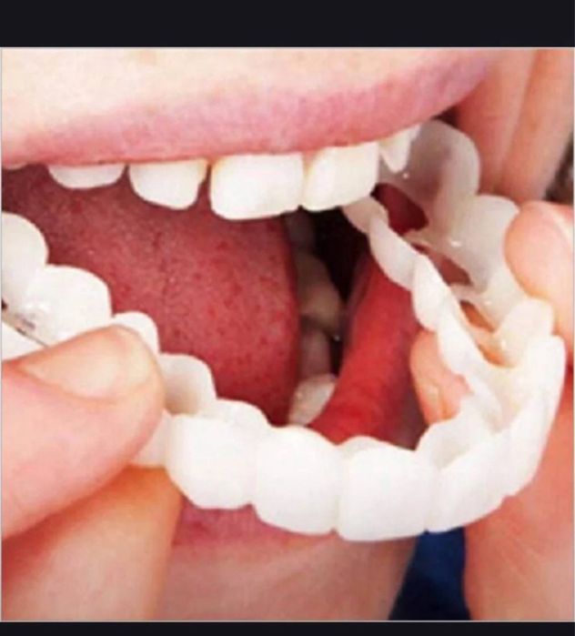 виниры для зубов съмнве