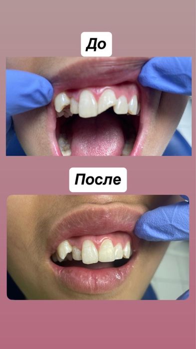 Стоматологические услуги