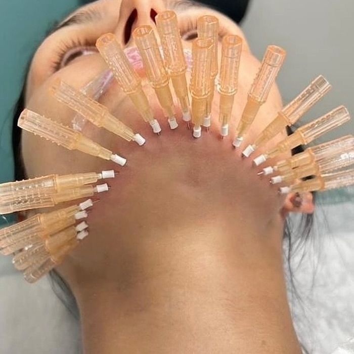 Услуги косметолога эстетиста! Все виды процедур