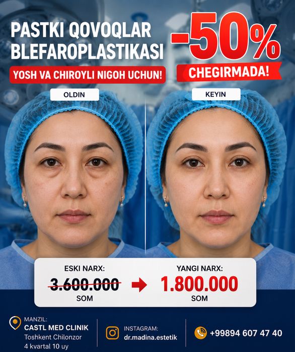 -50% CHEGIRMADA Qovoqlar Blefaroplastikasi