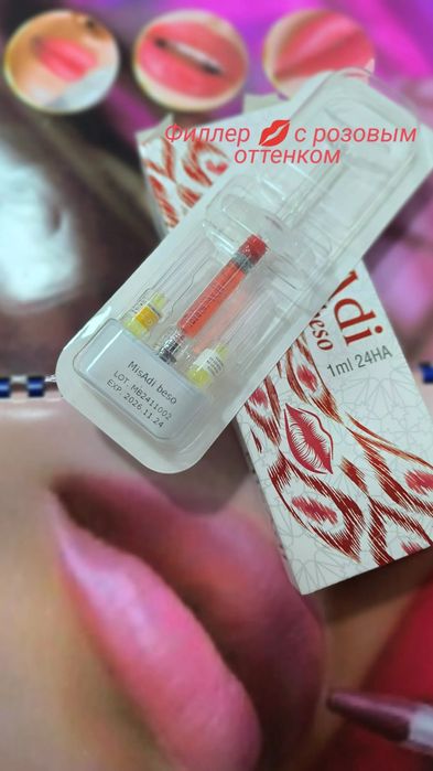 Красота это -губки бантиком на новый год! Botox full face