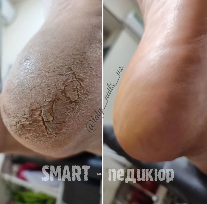 Маникюр, Педикюр, Наращивание ногтей, Мужской Маникюр и педикюр