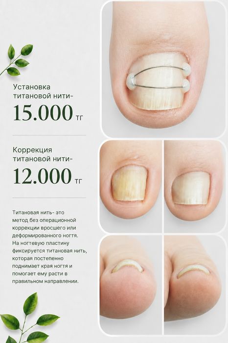 Педикюр, подолог