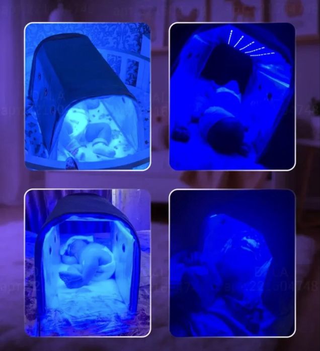 Лампа от желтушки