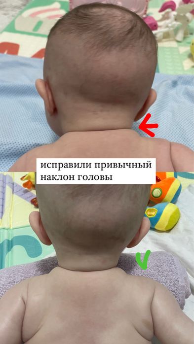 Детский массажист педиатр Алматы