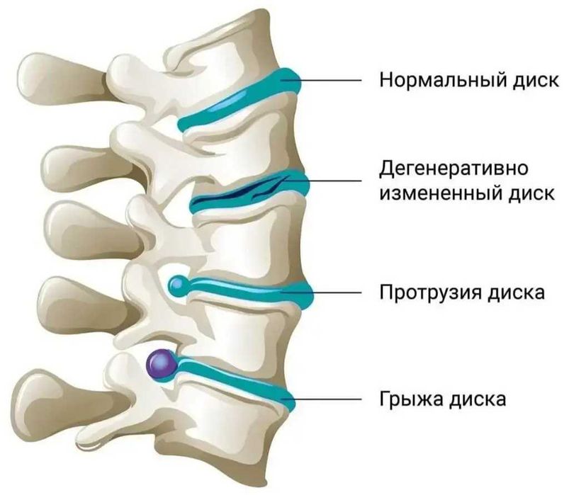 Лечебный массаж.