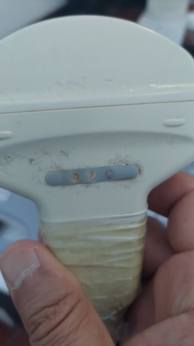 Узи датчик опкеберамиз любой аппаратга арзон нархда uzi datchik