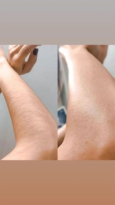 Депиляция еднди уйингизга бориб хизматингизда