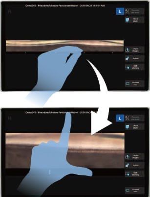 Гониоскоп NIDEK GS-1