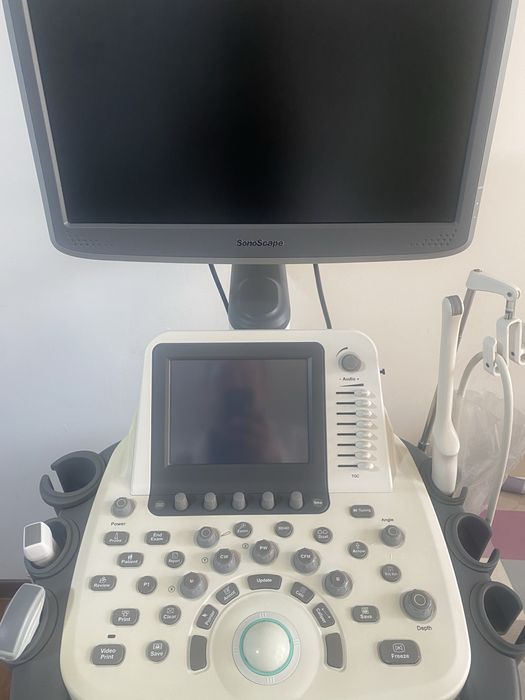 UZI aparati srochna sotiladi ideal xolatda 1 kishi foydalangan