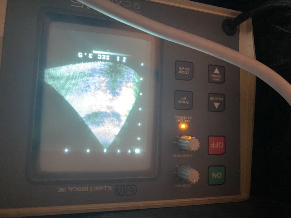 ехограф Ultra Scan 45