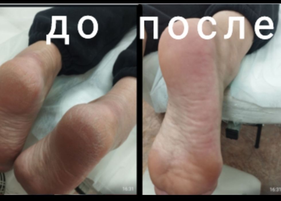 Маникюр, педикюр