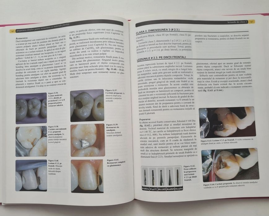 Mount - Conservarea si restaurarea structurii dentare