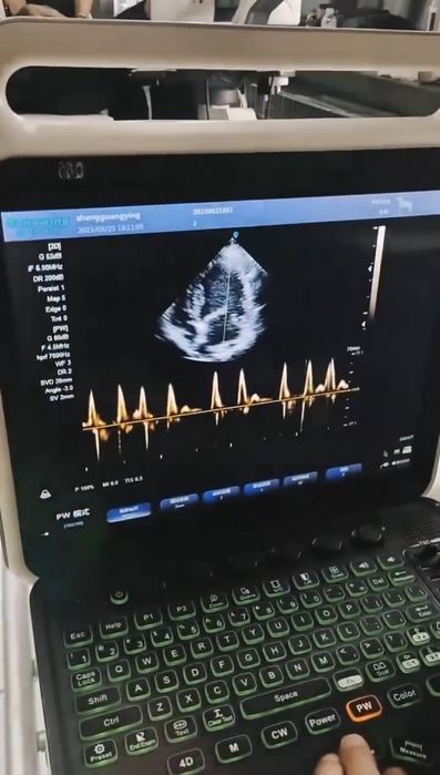 Портативный Узи 9.600$