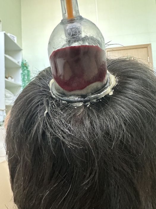 Хиджама в районе 45 квартала