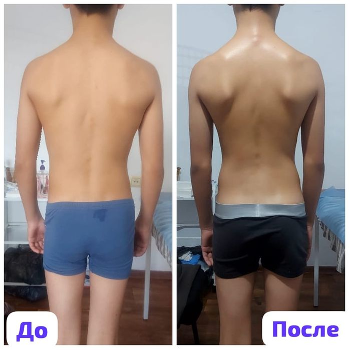 Мануальная терапия/массаж/иглотерапия