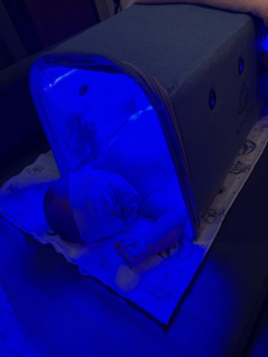 Ультрофиолетовая лампа для билирубина