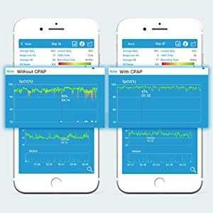 Wellue Sleep O2 Oxigen monitor кислороден монитор на съня с аларма