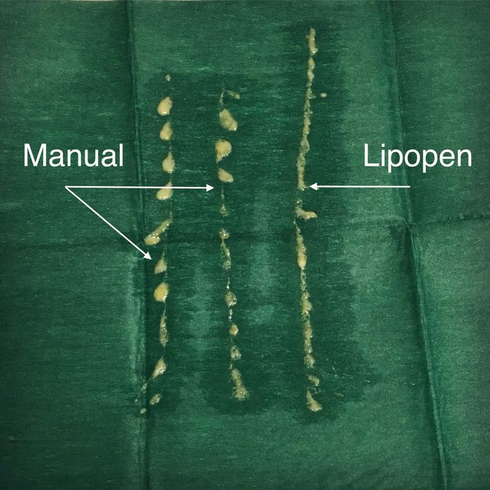 Lipopen - dispozitiv de injectare de ultimă generație - NOU