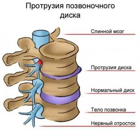 Лечебный массаж.