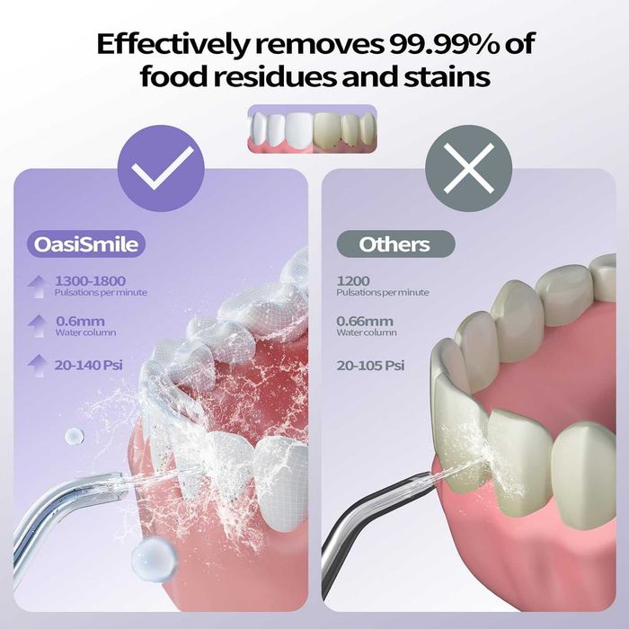 OasiSmile Воден флосер за почистване на зъби, 260 мл преносим безжичен иригатор