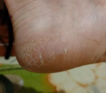 Продам крем-воск от трещин