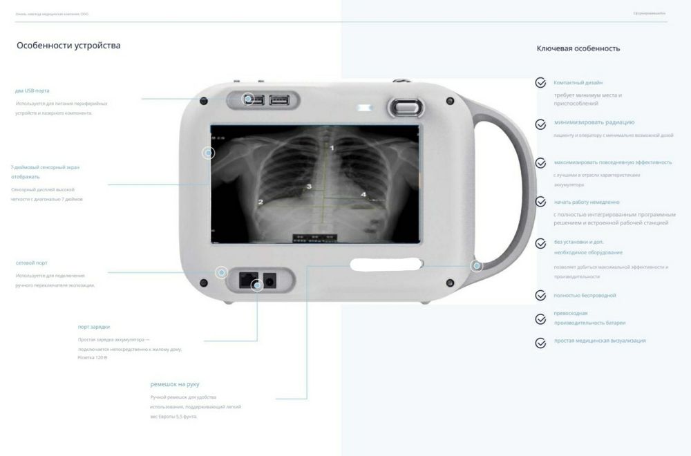 Портативный цифровой рентген аппарат. Mobile X-ray