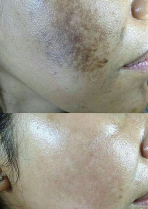 Требуются модели на косметологические процедуры