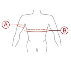 Orteză neurologică Reh4mat pentru mâna dreaptă (după AVC)