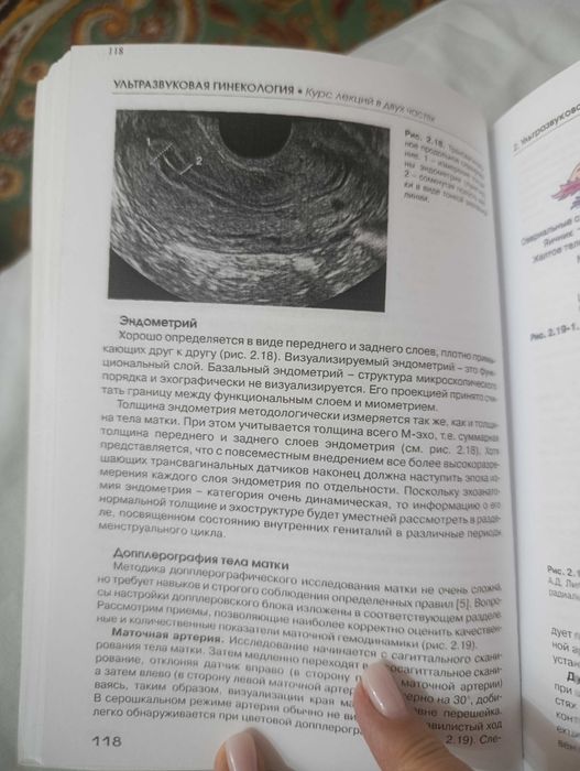 Книги по УЗИ Митькова
