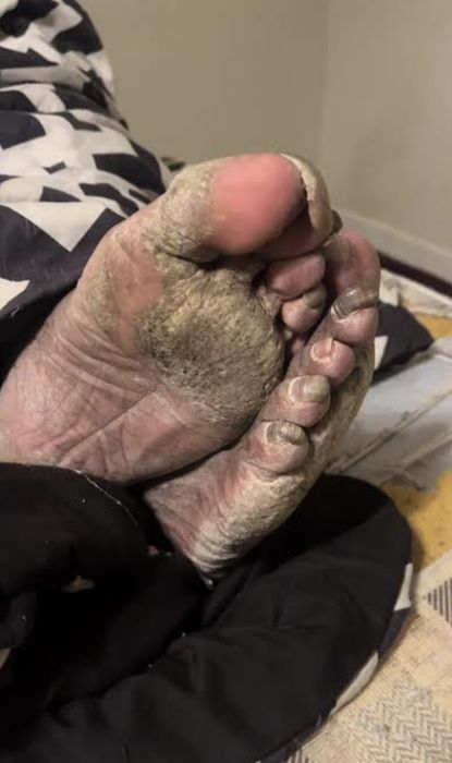 Feet peaks foarte frumoase