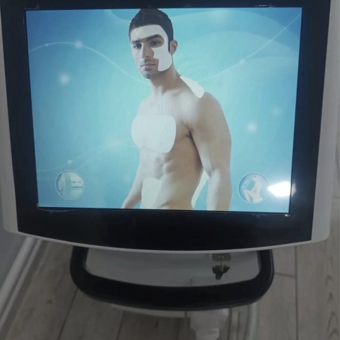 Продам лазерный аппарат