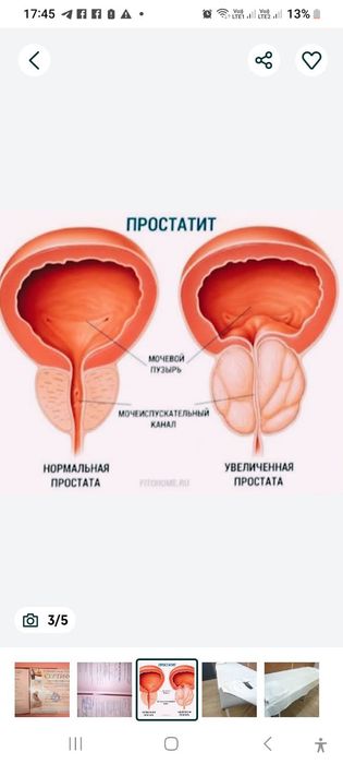 Пилинг у себя Акция